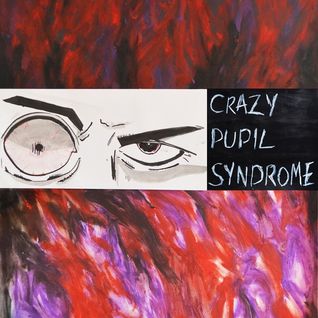 Crazy Pupil Syndrome